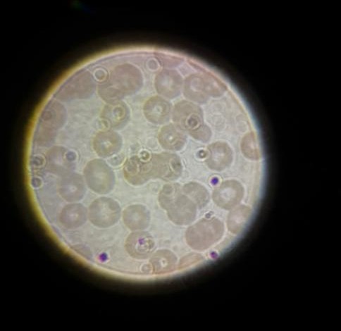 Blood cells under high magnification microscopy