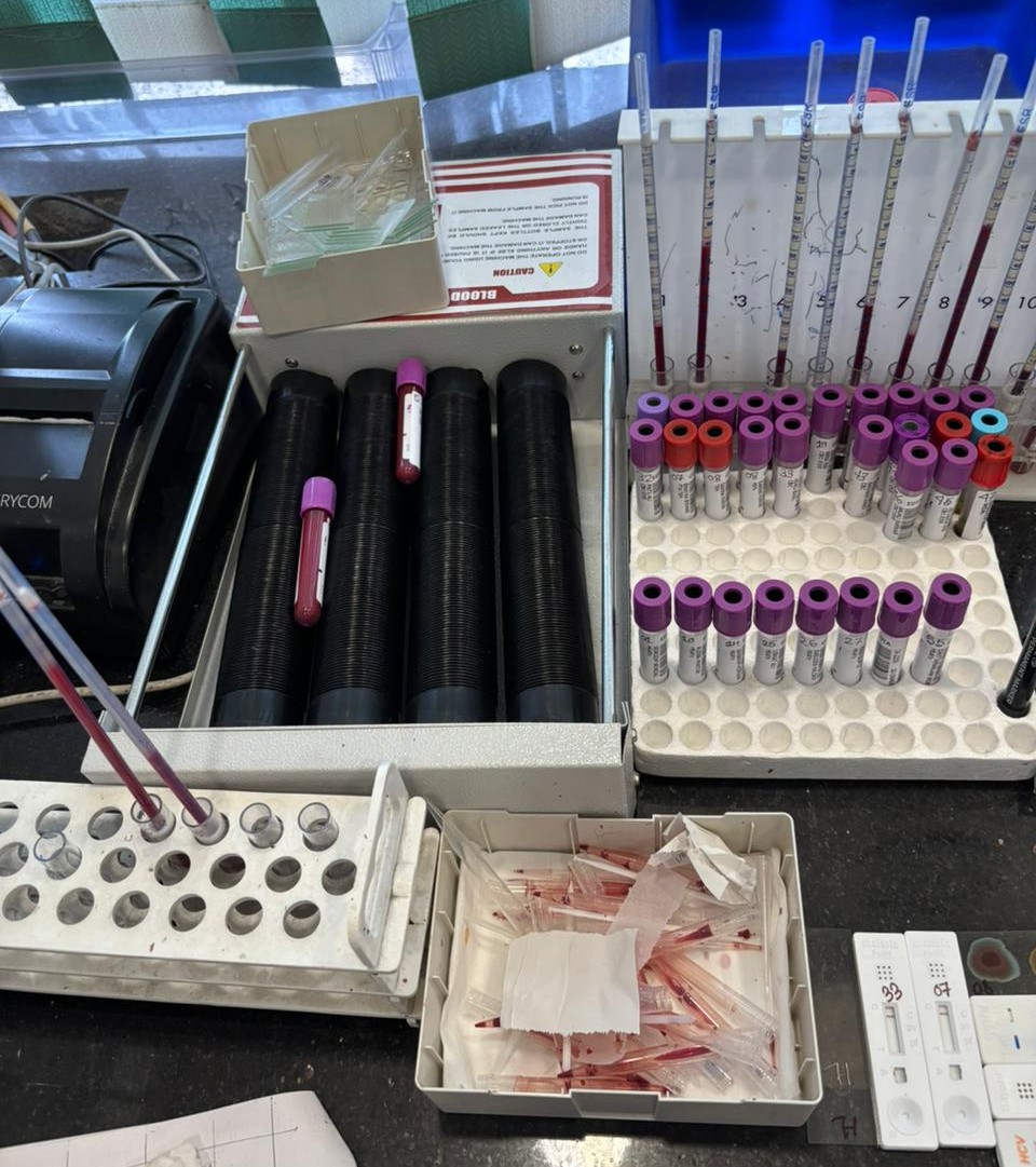 Blood collection tubes, ESR setup and rapid test kits