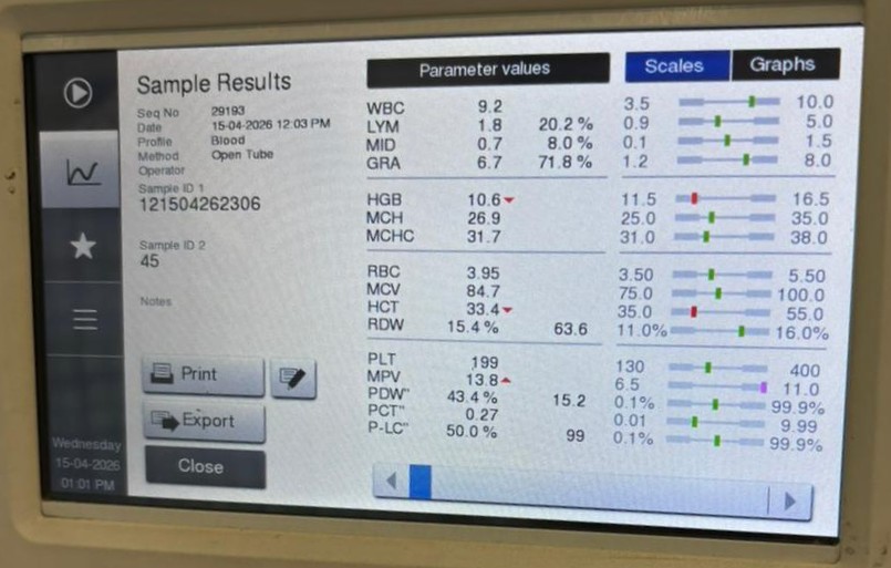 Hematology analyzer sample results interface